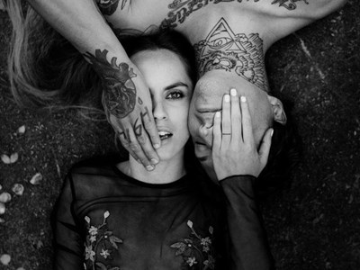 Laser Tattoo Removal